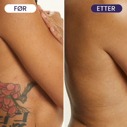 Body Coverage Cream - Dekk mørke flekker, urenheter og akne enkelt