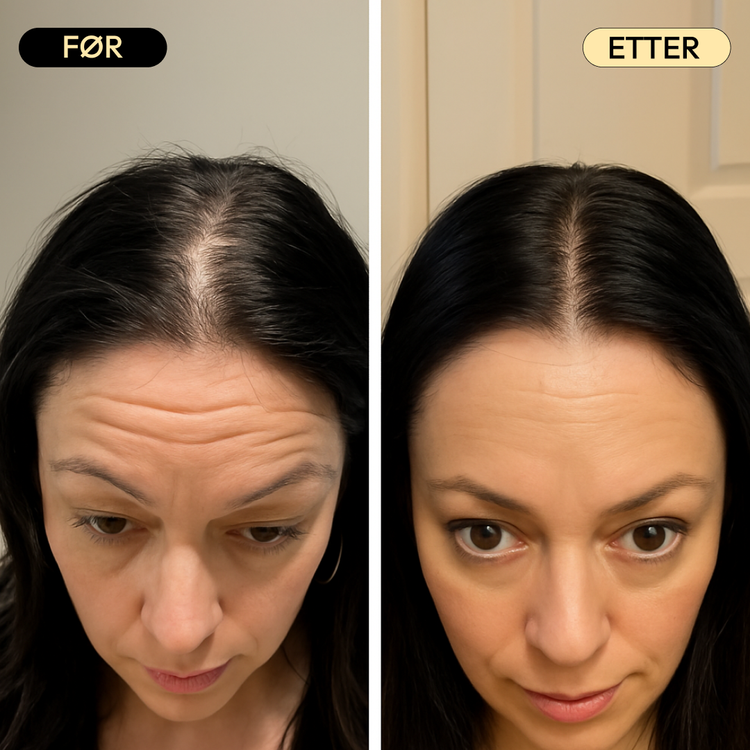HairBoost -  Fyldigere hår uten sterke kjemikalier