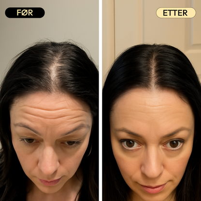 HairBoost -  Fyldigere hår uten sterke kjemikalier