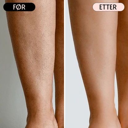 SoftGlide - Perfekt barbering uten barberingsutslett