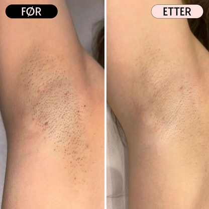 SoftGlide - Perfekt barbering uten barberingsutslett