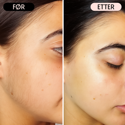 SoftGlide - Perfekt barbering uten barberingsutslett