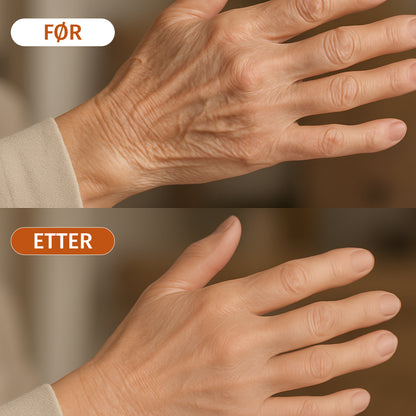 Besque™ - Fjern strekkmerker og stram opp huden